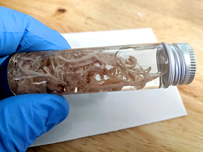 Clots found in vaccinated cadavers